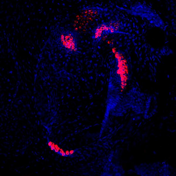 Confocal microscope image of Xenopus laevis vestibular hair cells labled with DSHB antibody Myo7A 138-1 (red). Image Credit: Karen Elliott Thompson